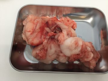 犬の浸潤性脂肪腫の画像